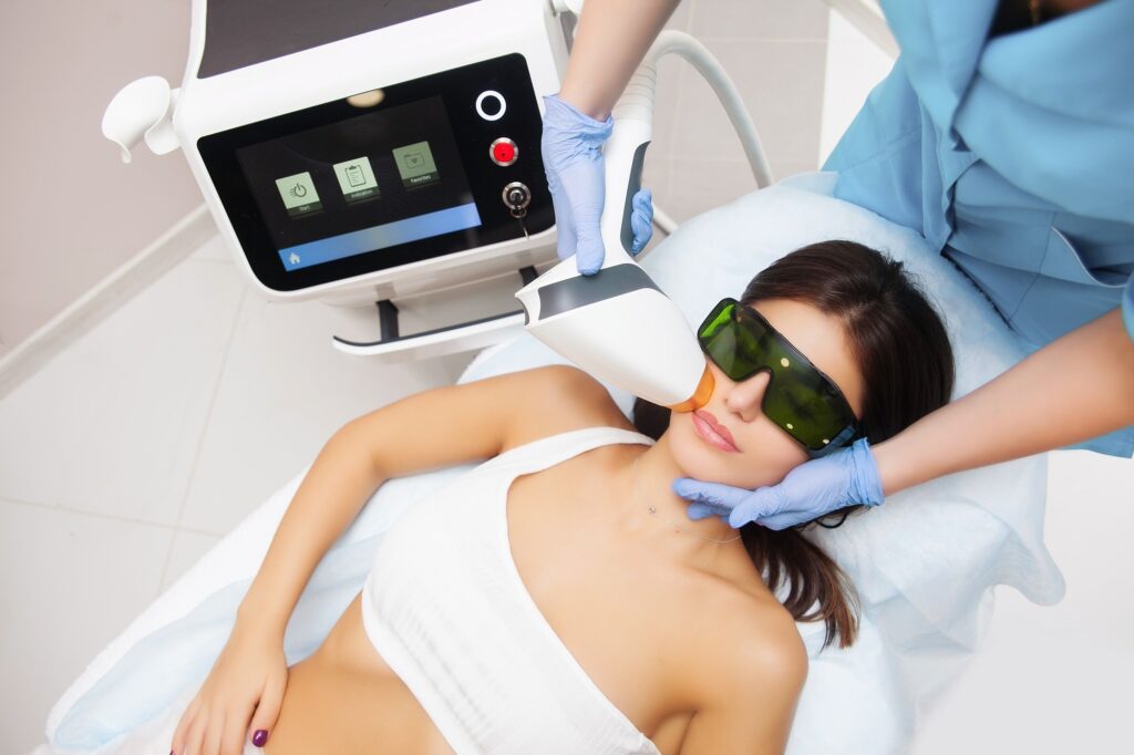 Epilazione laser